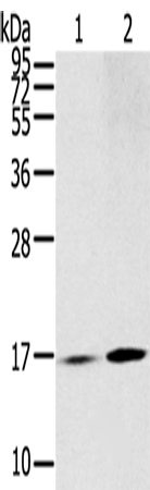 RPLP1