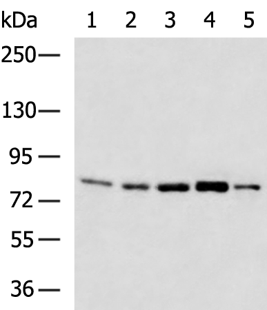 SENP5