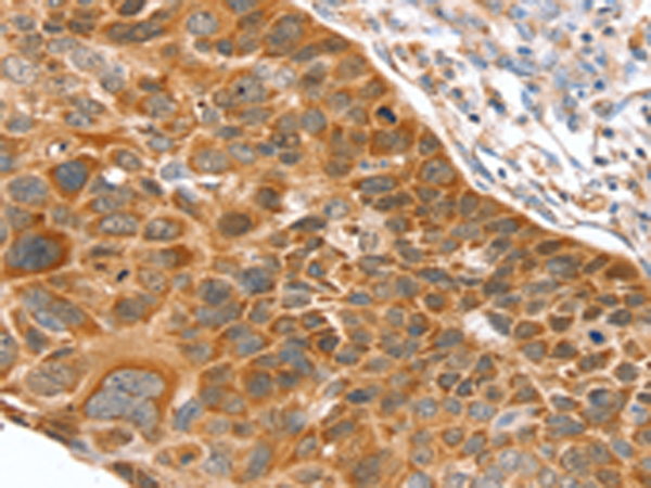 Rabbit Polyclonal Antibody to SLC27A2