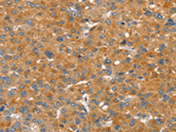 Rabbit Polyclonal Antibody to SLC29A4