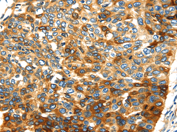 Rabbit Polyclonal Antibody to SMYD4