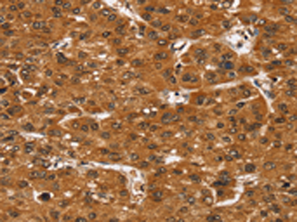 Rabbit Polyclonal Antibody to SMARCB1