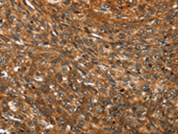 Rabbit Polyclonal Antibody to SMARCB1