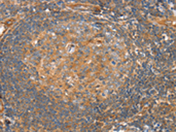 SRGAP3
