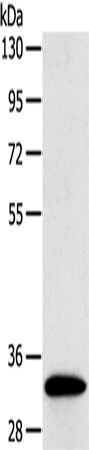 SULT1B1