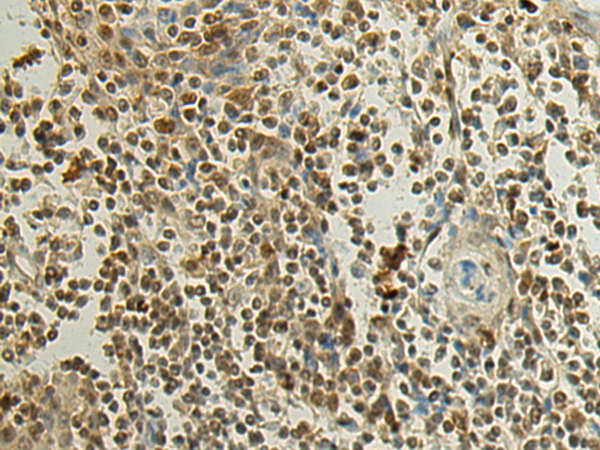 Rabbit Polyclonal Antibody to SURF6