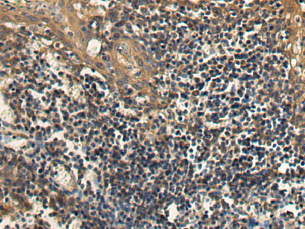 Rabbit Polyclonal Antibody to SFTPA2