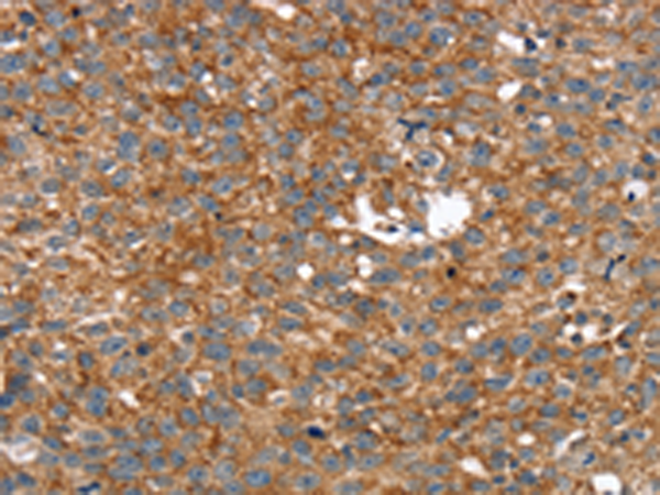 ARMC10