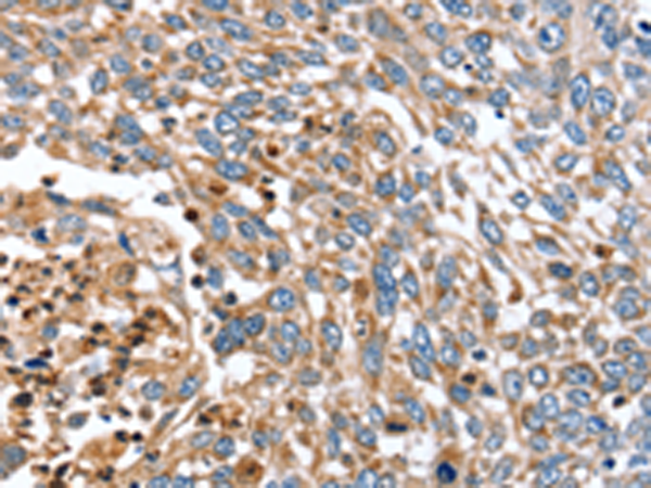 Rabbit Polyclonal Antibody to ARMC10