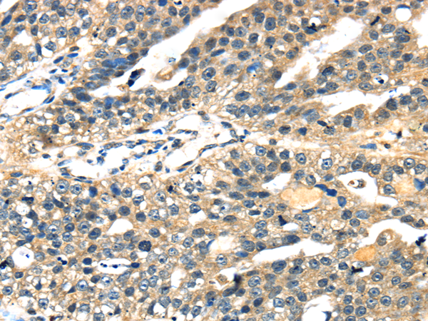 Rabbit Polyclonal Antibody to STX7