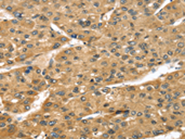 Rabbit Polyclonal Antibody to STX8