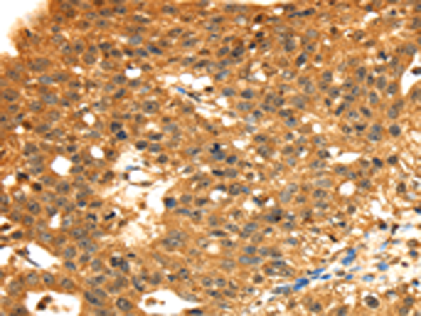 Rabbit Polyclonal Antibody to STX8