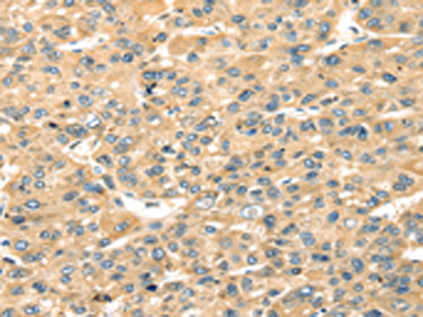 Rabbit Polyclonal Antibody to STX18
