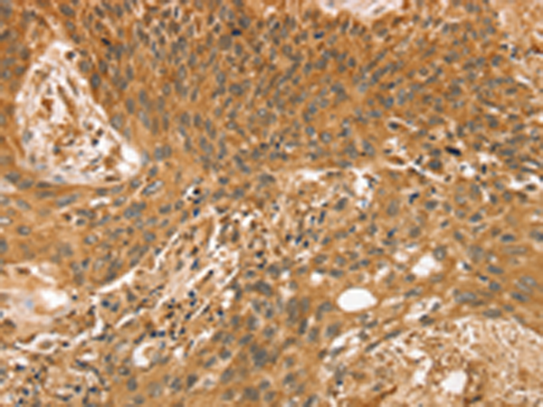 Rabbit Polyclonal Antibody to STX10