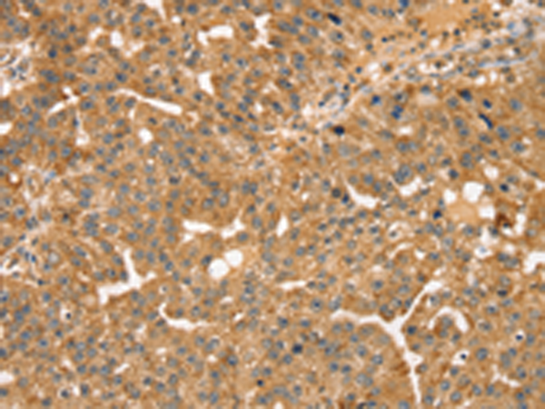 Rabbit Polyclonal Antibody to STX10
