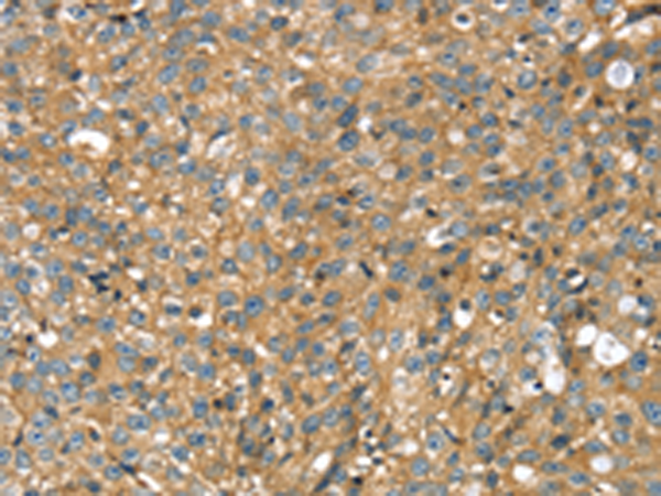 Rabbit Polyclonal Antibody to STX11