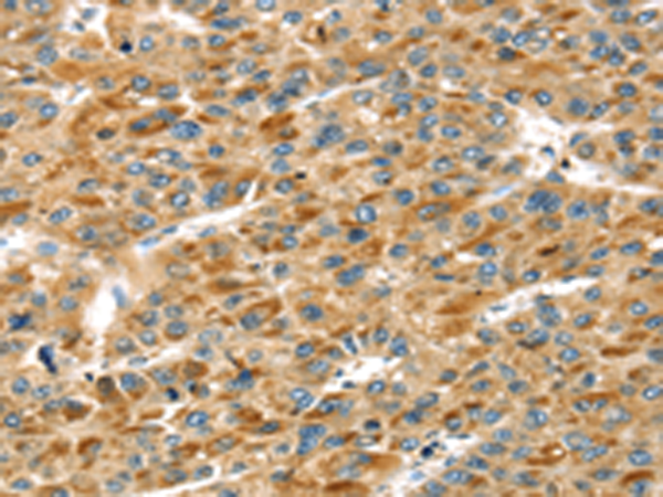 Rabbit Polyclonal Antibody to STX11