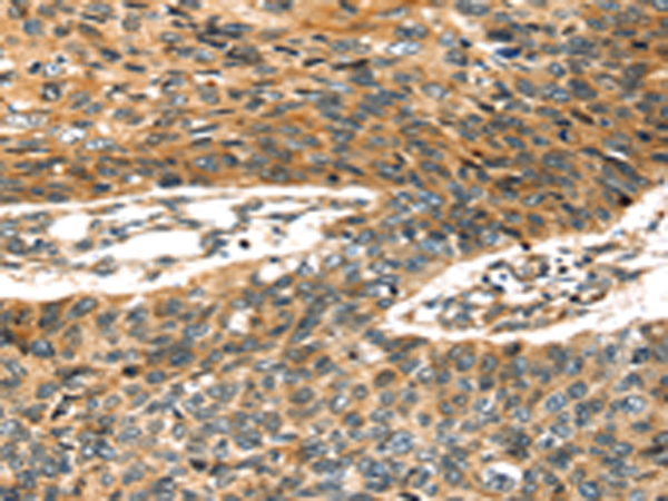 Rabbit Polyclonal Antibody to STX19