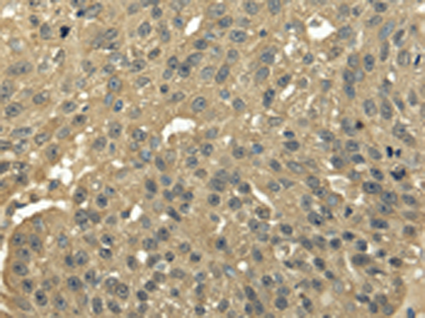 TFDP2