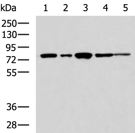 TLK2