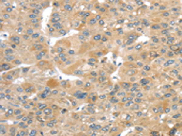 TMEM161A