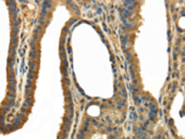 TRPC4AP
