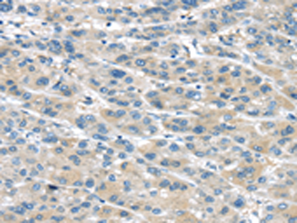 TRPM2