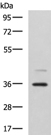 UBLCP1