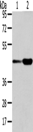 VPS37A