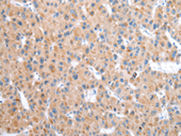 CFAP52