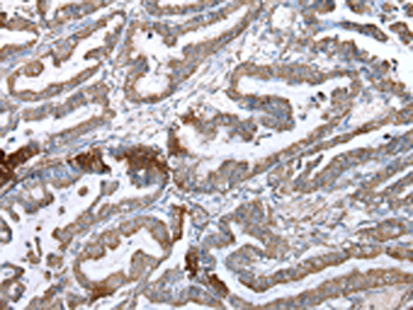 Rabbit Polyclonal Antibody to ZDHHC20