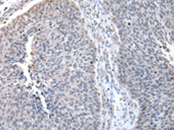 ZNF23