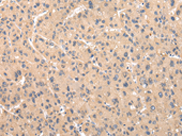 ZNF268