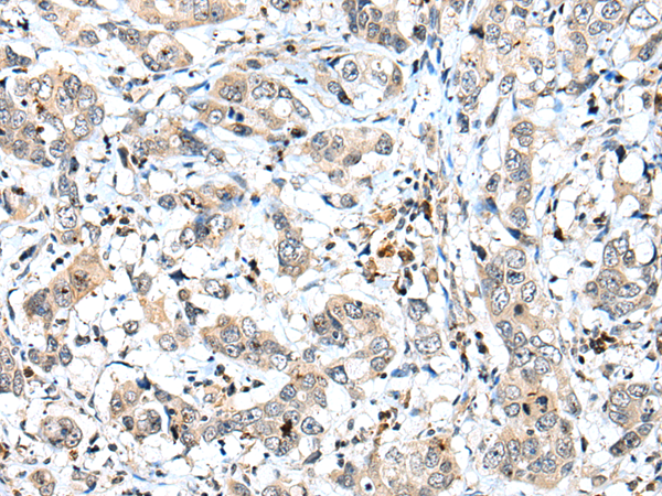 Rabbit Polyclonal Antibody to SPCS2