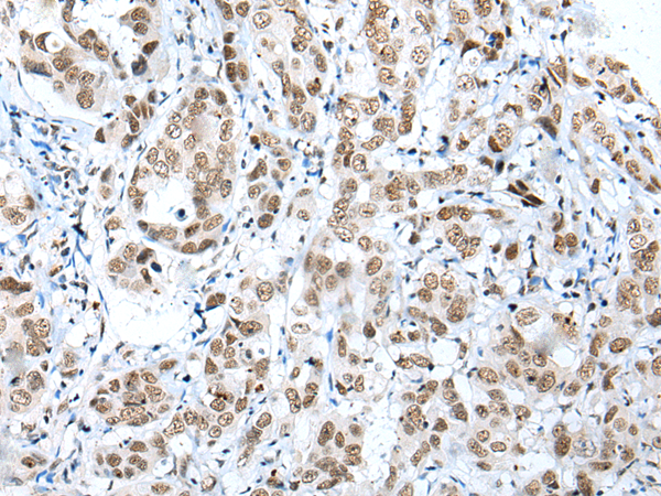 Rabbit Polyclonal Antibody to NUDT21