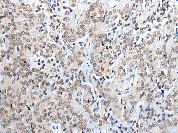 Rabbit Polyclonal Antibody to NUDT21