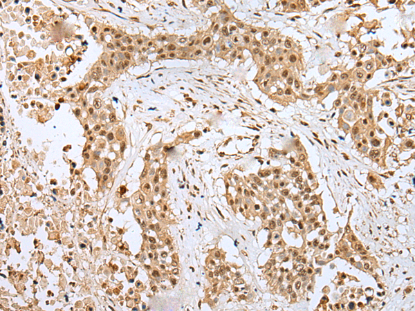 RHEBL1