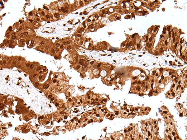 Rabbit Polyclonal Antibody to GAR1