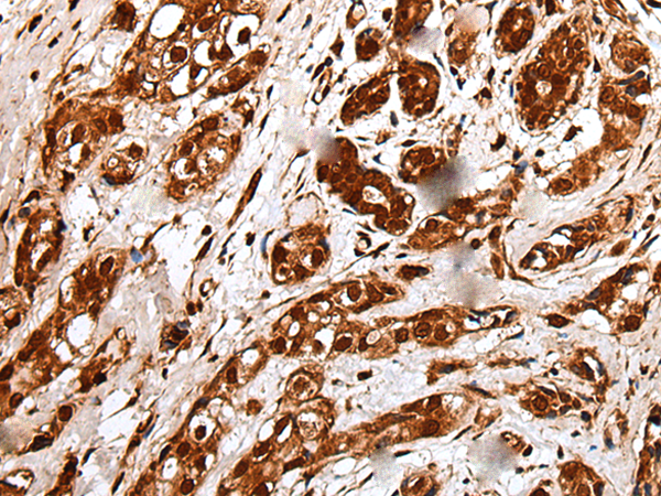 Rabbit Polyclonal Antibody to GAR1