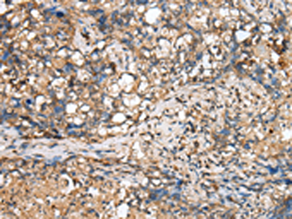 Rabbit Polyclonal Antibody to TINAGL1