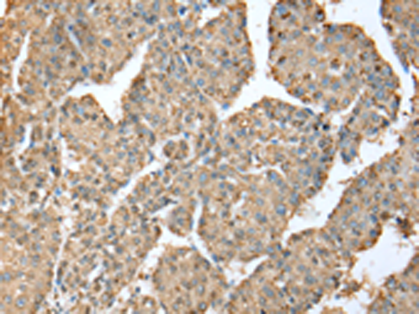 Rabbit Polyclonal Antibody to METTL7A