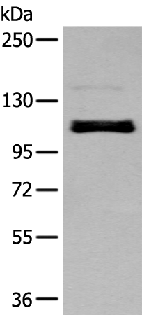 ZNF281