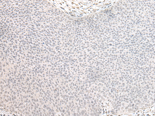 ZNF138