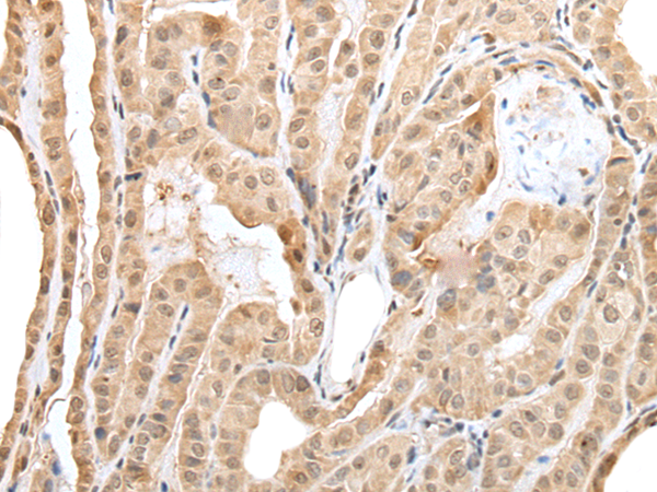 ZNF202