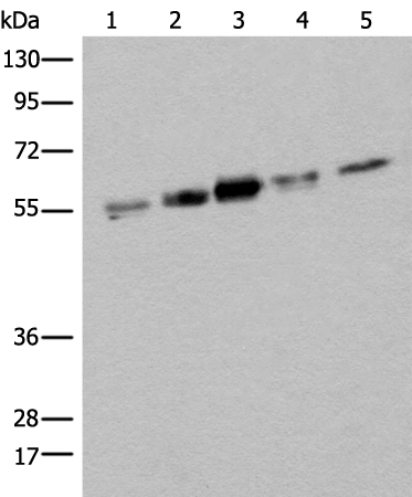 ZPR1