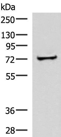 ZNF263