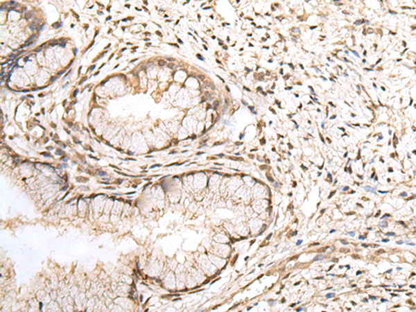 ZNF266