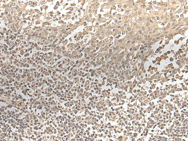 ZNF274