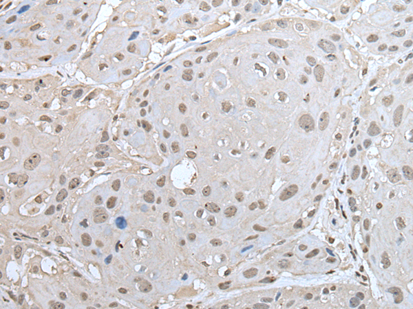 ZNF302