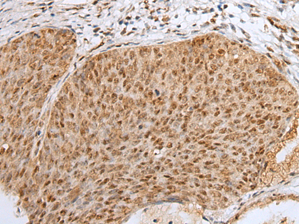ZNF354A